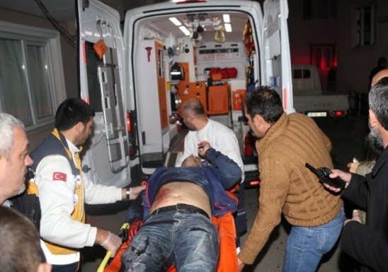 POMPALI TÜFEKLE AĞIR YARALADI