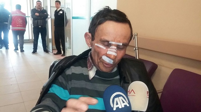 YARALI YOLCU KAZAYI ANLATTI