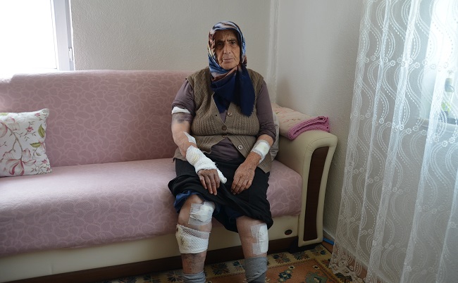 KÖPEKLER SALDIRDI ZOR KURTULDU