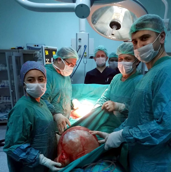 KARNINDAN 13 KİLOLUK KİTLE ÇIKTI