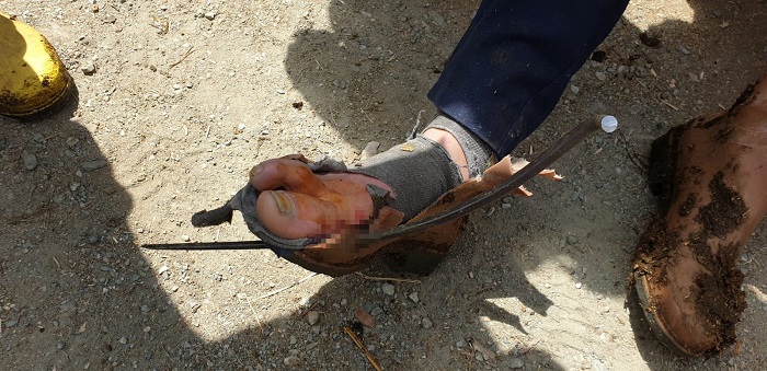 AHIRDA AYAĞINA YABA SAPLANDI