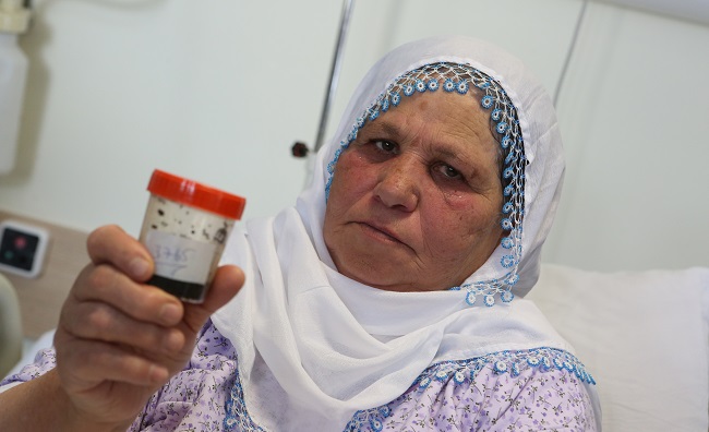 SAFRA KESESİNDEN 3 BİN TAŞ ÇIKTI