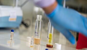 HİTİT’DEN AVRUPA’YA LABORATUVAR HİZMETİ