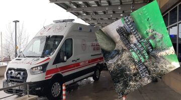 Çocuğun ayağı makinede koptu!