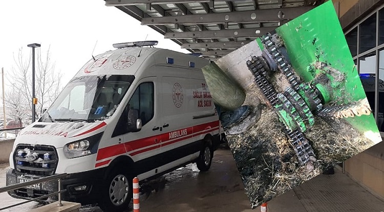Çocuğun ayağı makinede koptu!