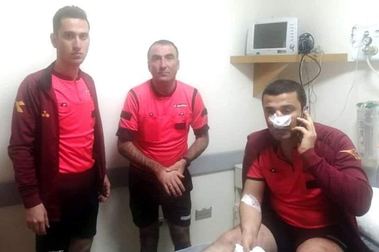 Çorum’da hakemin burnu kırıldı!