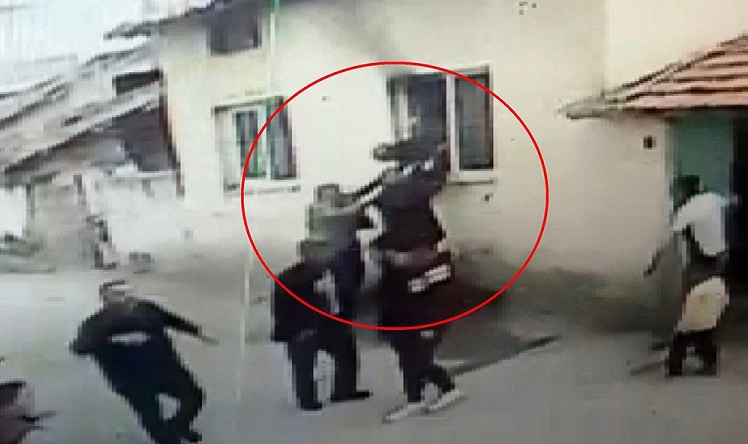 Yangında yaralanmıştı hayatını kaybetti