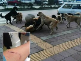 Köpeklerin saldırısı hastanelik etti!